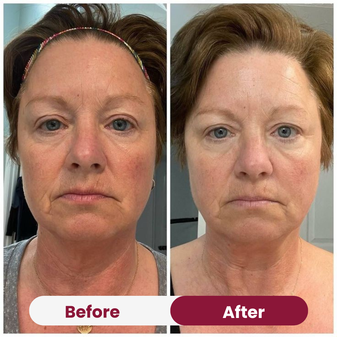 Anti-Wrinkle Collagen Mask 32 108 076472cf 8908 4600 bd51 ede095696ef0